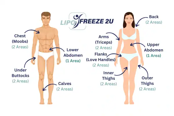 Areas you can have fat freezing treatment Kew