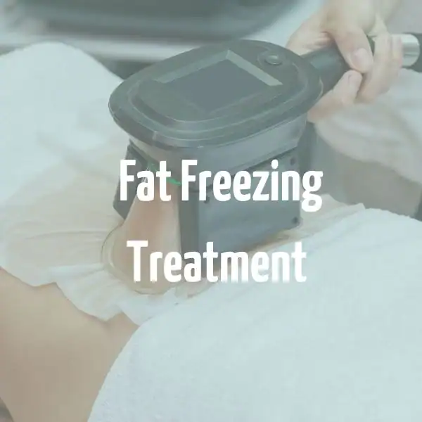 fat freezing treatment Kew