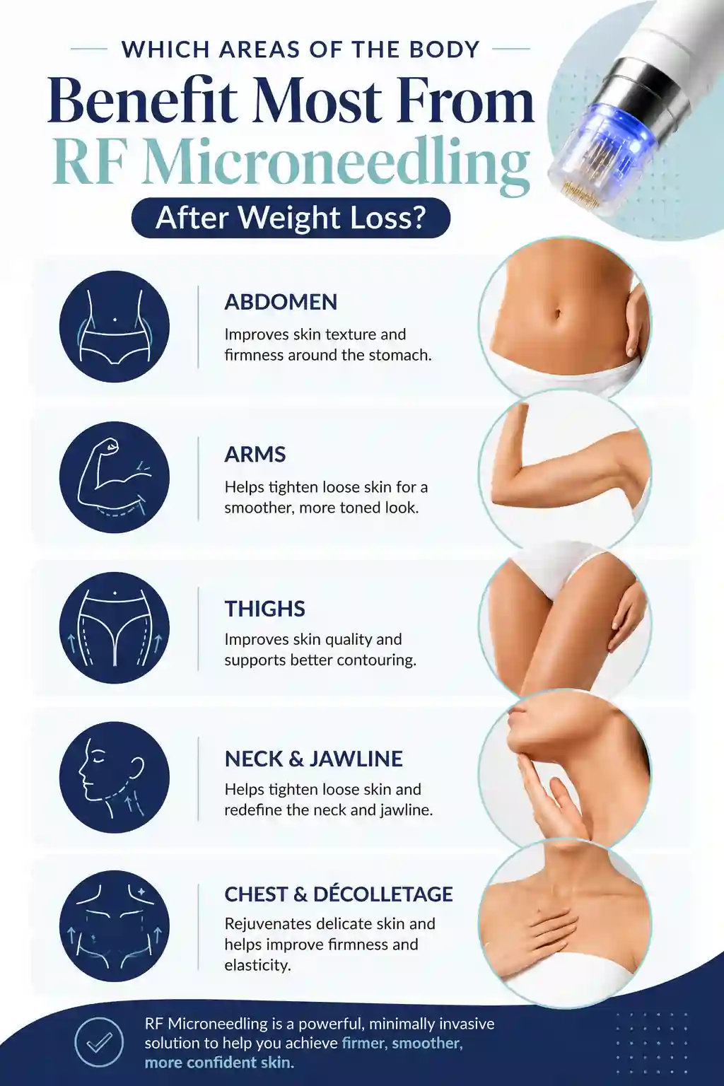 Which Areas of the Body Benefit Most From RF Microneedling After Weight Loss Kew